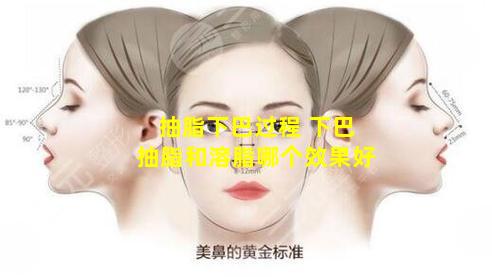 抽脂下巴过程 下巴抽脂和溶脂哪个效果好